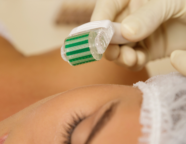 Microneedling Beauty Therapy + Skin Specialists Wanaka - Silver Sixpence